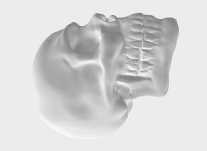 Human skull
