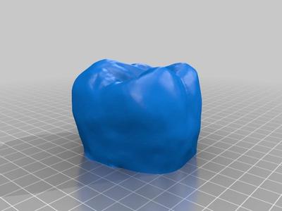 Molar 16 (Human teeth)
