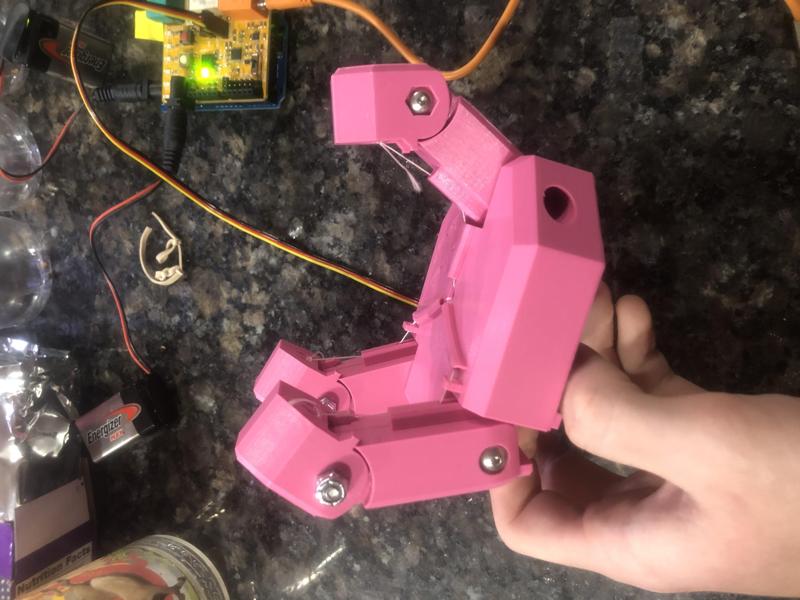 3D Printed Prosthetic (Project)