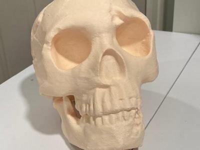 Neanderthal Skull